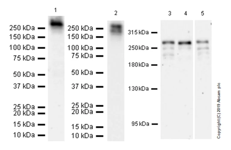Western blot - Anti-Neurofibromin antibody [EPR22989-68] (AB238142)