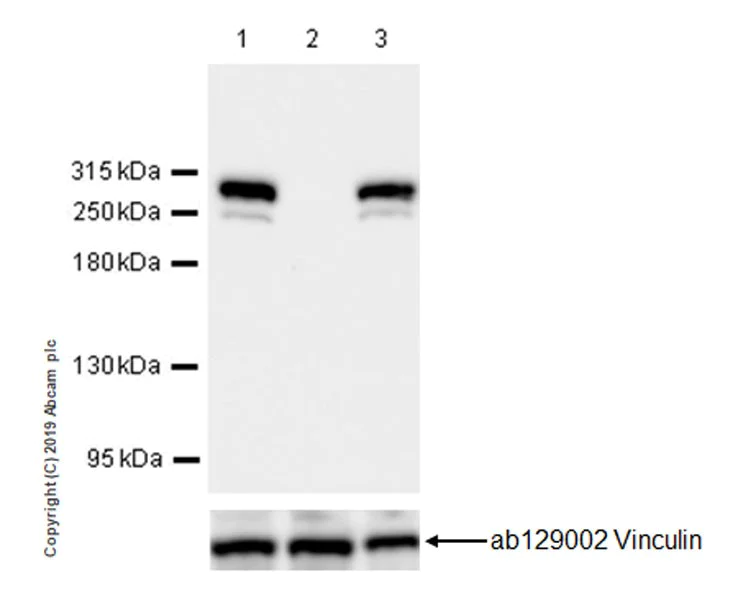 Western blot - Anti-Neurofibromin antibody [EPR22989-68] - BSA and Azide free (AB260004)