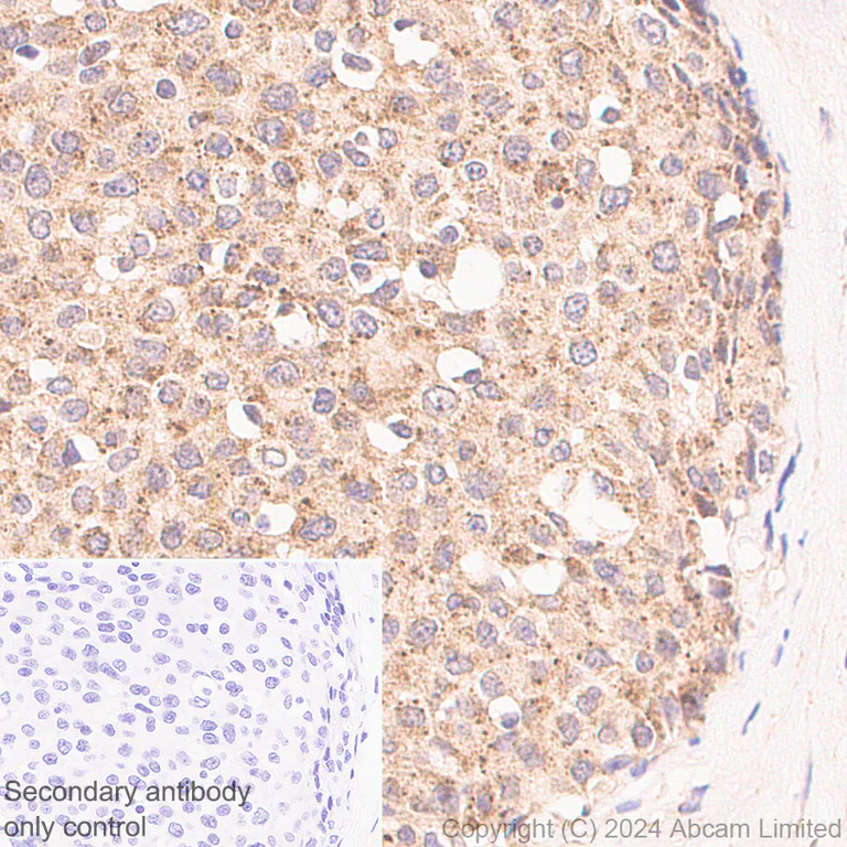 Immunohistochemistry (Formalin/PFA-fixed paraffin-embedded sections) - Anti-Neurofibromin antibody [EPR29029-32] (AB322658)