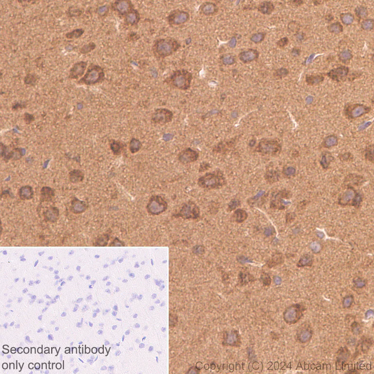 Immunohistochemistry (Formalin/PFA-fixed paraffin-embedded sections) - Anti-Neurofibromin antibody [EPR29029-32] (AB322658)
