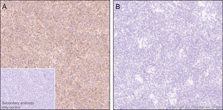 Immunohistochemistry (Formalin/PFA-fixed paraffin-embedded sections) - Anti-Neurofibromin antibody [EPR29029-32] (AB322658)