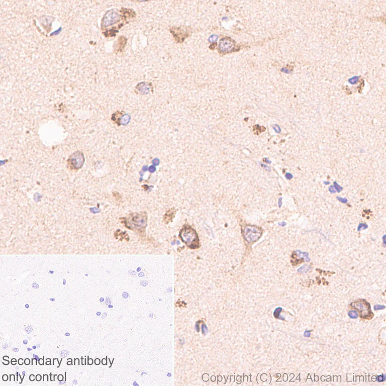 Immunohistochemistry (Formalin/PFA-fixed paraffin-embedded sections) - Anti-Neurofibromin antibody [EPR29029-32] - BSA and Azide free (AB324830)