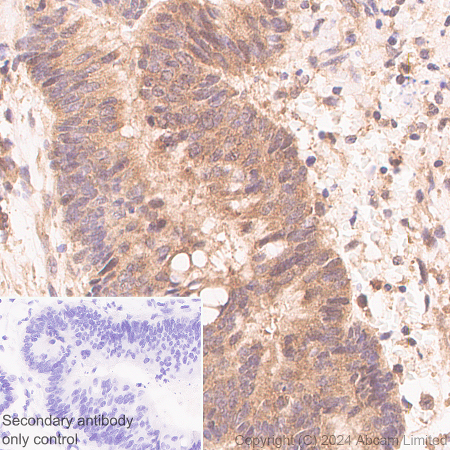 ipin Ꮚ•̤༝•̤Ꮚ　E本体5本b Anti-Neurofibromin antibody [EPR29029-32] - BSA and Azide free