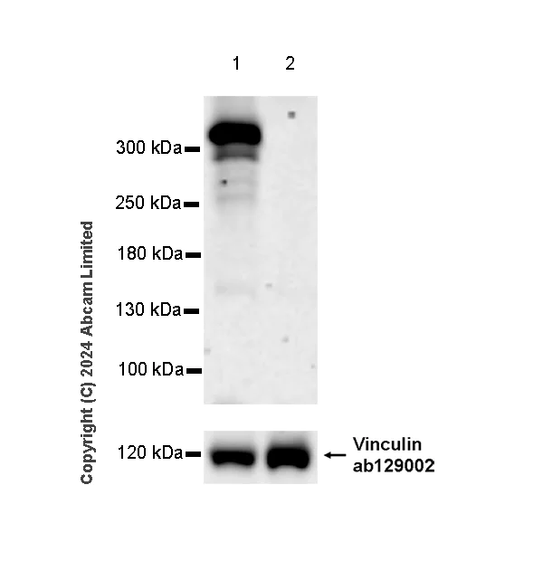 Western blot - Anti-Neurofibromin antibody [EPR29029-32] - BSA and Azide free (AB324830)