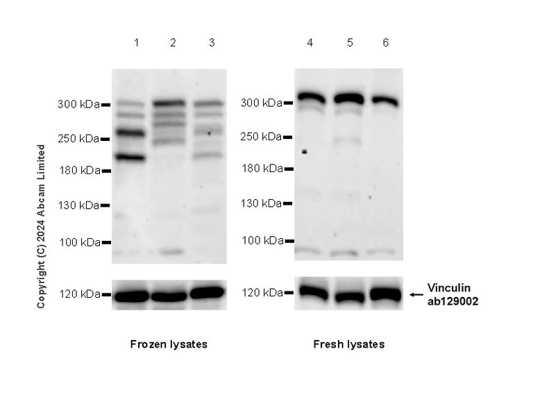 Western blot - Anti-Neurofibromin antibody [EPR29029-32] - BSA and Azide free (AB324830)