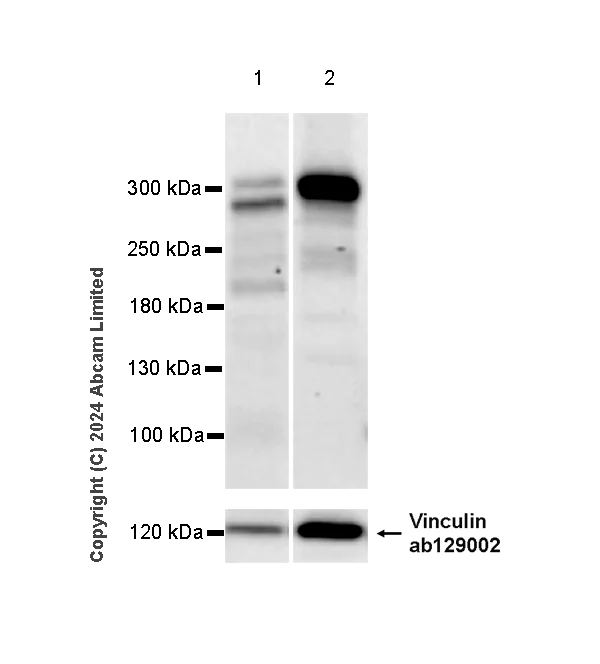 Western blot - Anti-Neurofibromin antibody [EPR29029-32] - BSA and Azide free (AB324830)