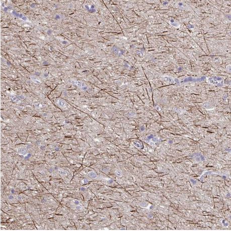 Immunohistochemistry (Formalin/PFA-fixed paraffin-embedded sections) - Anti-Neurofilament antibody (AB204893), expandable thumbnail
