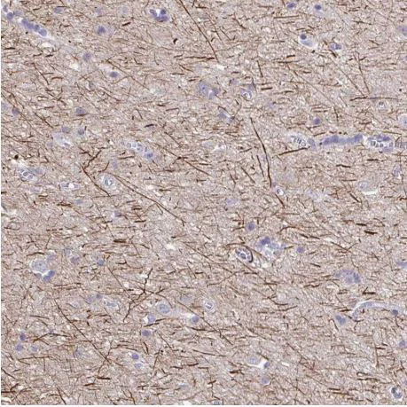Immunohistochemistry (Formalin/PFA-fixed paraffin-embedded sections) - Anti-Neurofilament antibody (AB204893)