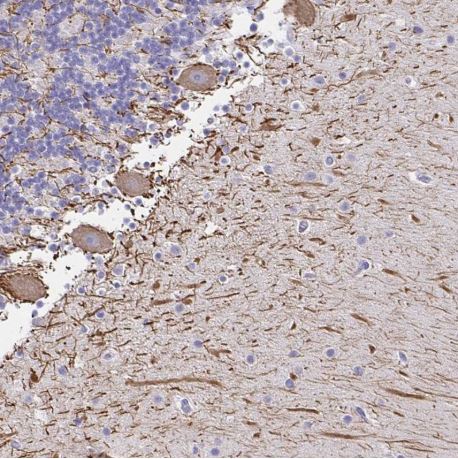 Immunohistochemistry (Formalin/PFA-fixed paraffin-embedded sections) - Anti-Neurofilament antibody (AB204893), expandable thumbnail