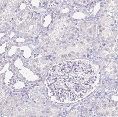 Immunohistochemistry (Formalin/PFA-fixed paraffin-embedded sections) - Anti-Neurofilament antibody (AB204893), expandable thumbnail