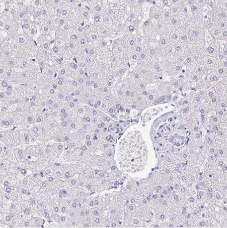 Immunohistochemistry (Formalin/PFA-fixed paraffin-embedded sections) - Anti-Neurofilament antibody (AB204893), expandable thumbnail