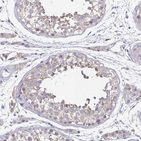 Immunohistochemistry (Formalin/PFA-fixed paraffin-embedded sections) - Anti-Neurofilament antibody (AB204893), expandable thumbnail