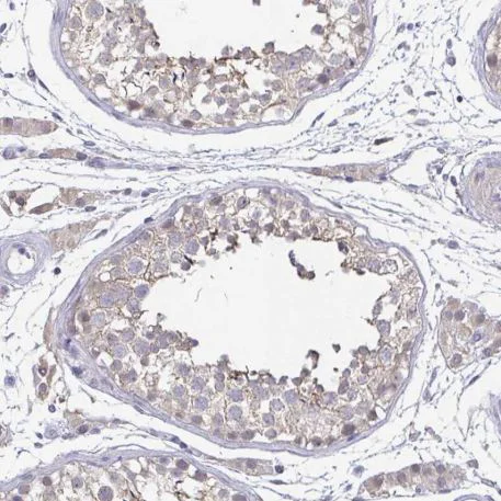 Immunohistochemistry (Formalin/PFA-fixed paraffin-embedded sections) - Anti-Neurofilament antibody (AB204893)