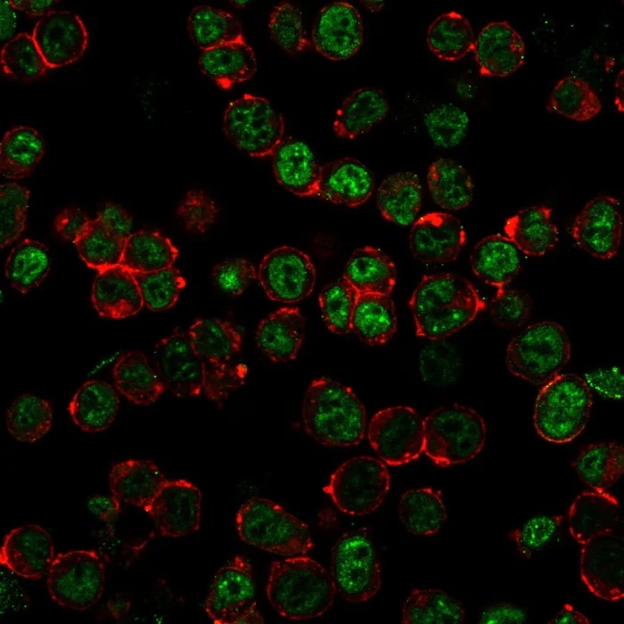 Immunocytochemistry - Anti-Neurofilament antibody [NF421 + NFL/736] (AB215903)