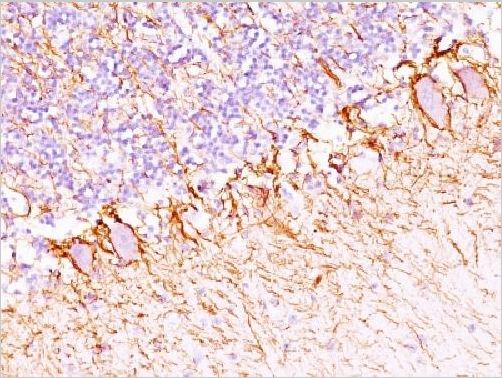Immunohistochemistry (Formalin/PFA-fixed paraffin-embedded sections) - Anti-Neurofilament antibody [NF421 + NFL/736] - BSA and Azide free (AB213128)