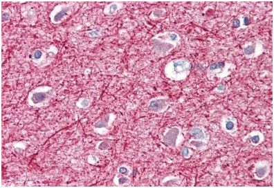 Immunohistochemistry (Formalin/PFA-fixed paraffin-embedded sections) - Anti-Neurofilament antibody [RNF406] - Neuronal Marker (AB134306)