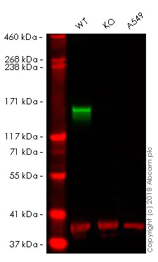 Western blot - Anti-Neurofilament antibody [RNF406] - Neuronal Marker (AB134306)