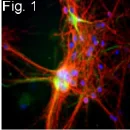 Immunocytochemistry/ Immunofluorescence - Anti-Neurofilament heavy polypeptide antibody [3G3] (AB19386)