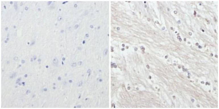 Immunohistochemistry (Formalin/PFA-fixed paraffin-embedded sections) - Anti-Neurofilament heavy polypeptide antibody [3G3] (AB19386), expandable thumbnail