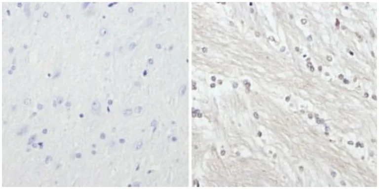 Immunohistochemistry (Formalin/PFA-fixed paraffin-embedded sections) - Anti-Neurofilament heavy polypeptide antibody [3G3] (AB19386)
