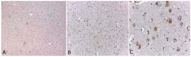 Immunohistochemistry (Formalin/PFA-fixed paraffin-embedded sections) - Anti-Neurofilament heavy polypeptide antibody [3G3] (AB19386), expandable thumbnail