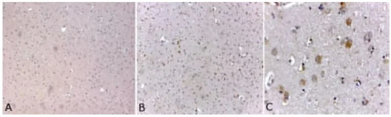 Immunohistochemistry (Formalin/PFA-fixed paraffin-embedded sections) - Anti-Neurofilament heavy polypeptide antibody [3G3] (AB19386)