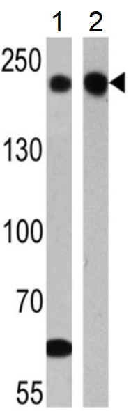 Western blot - Anti-Neurofilament heavy polypeptide antibody [3G3] (AB19386), expandable thumbnail