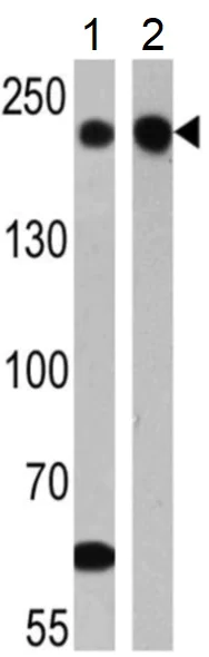 Western blot - Anti-Neurofilament heavy polypeptide antibody [3G3] (AB19386)