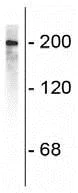 Western blot - Anti-Neurofilament heavy polypeptide antibody (AB72996)