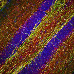 Immunohistochemistry - Free Floating - Anti-Neurofilament heavy polypeptide antibody (AB8135)