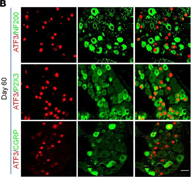 Immunohistochemistry - Anti-Neurofilament heavy polypeptide antibody (AB8135)