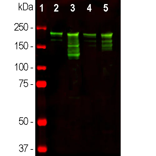 Western blot - Anti-Neurofilament heavy polypeptide antibody (AB8135)