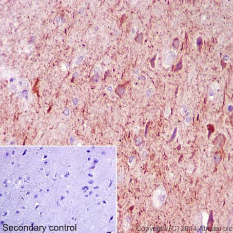 Immunohistochemistry (Formalin/PFA-fixed paraffin-embedded sections) - Anti-Neurofilament heavy polypeptide antibody [EP673Y] (AB40796)