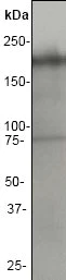 Western blot - Anti-Neurofilament heavy polypeptide antibody [EP673Y] (AB40796)