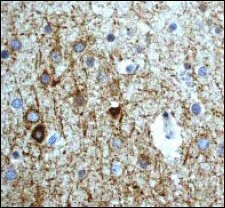 Immunohistochemistry (Formalin/PFA-fixed paraffin-embedded sections) - Anti-Neurofilament heavy polypeptide antibody [EP673Y] - BSA and Azide free (AB247290)