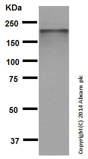 Western blot - Anti-Neurofilament heavy polypeptide antibody [EP673Y] - BSA and Azide free (AB247290)