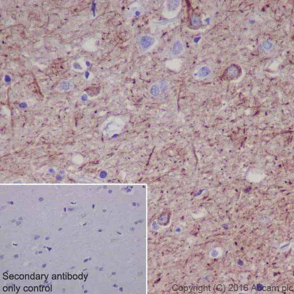 Immunohistochemistry (Formalin/PFA-fixed paraffin-embedded sections) - Anti-Neurofilament heavy polypeptide antibody [EPR20020] (AB207176)
