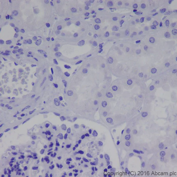 Immunohistochemistry (Formalin/PFA-fixed paraffin-embedded sections) - Anti-Neurofilament heavy polypeptide antibody [EPR20020] - BSA and Azide free (AB223139)