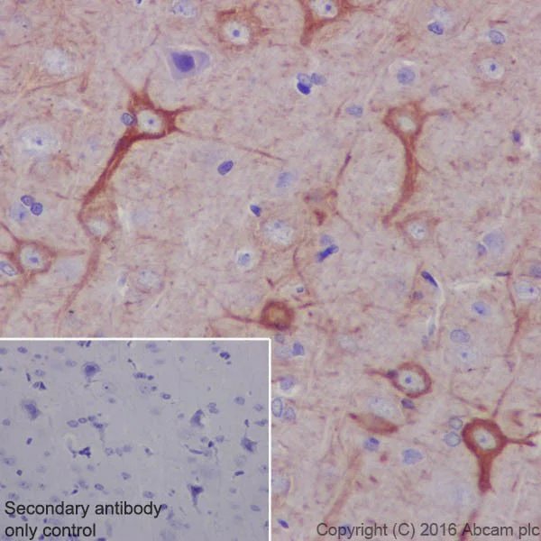 Immunohistochemistry (Formalin/PFA-fixed paraffin-embedded sections) - Anti-Neurofilament heavy polypeptide antibody [EPR20020] - BSA and Azide free (AB223139)