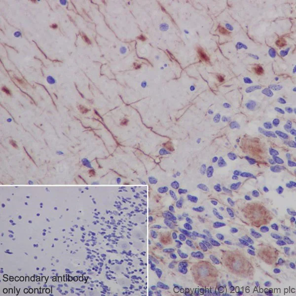 Immunohistochemistry (Formalin/PFA-fixed paraffin-embedded sections) - Anti-Neurofilament heavy polypeptide antibody [EPR20020] - BSA and Azide free (AB223139)
