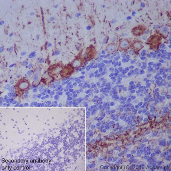 Immunohistochemistry (Formalin/PFA-fixed paraffin-embedded sections) - Anti-Neurofilament heavy polypeptide antibody [EPR20020] - BSA and Azide free (AB223139)