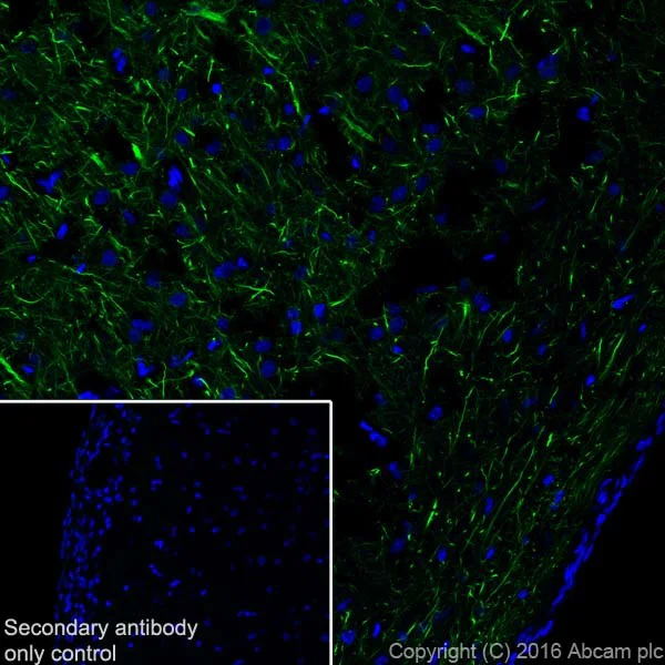 Immunohistochemistry (Frozen sections) - Anti-Neurofilament heavy polypeptide antibody [EPR20020] - BSA and Azide free (AB223139)