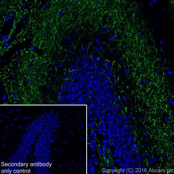 Immunohistochemistry (Frozen sections) - Anti-Neurofilament heavy polypeptide antibody [EPR20020] - BSA and Azide free (AB223139)