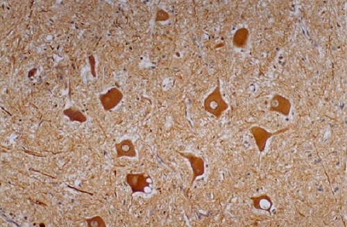 Immunohistochemistry (Formalin/PFA-fixed paraffin-embedded sections) - Anti-Neurofilament heavy polypeptide antibody [NF-01] (AB7795), expandable thumbnail