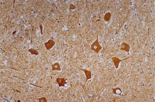 Immunohistochemistry (Formalin/PFA-fixed paraffin-embedded sections) - Anti-Neurofilament heavy polypeptide antibody [NF-01] (AB7795)