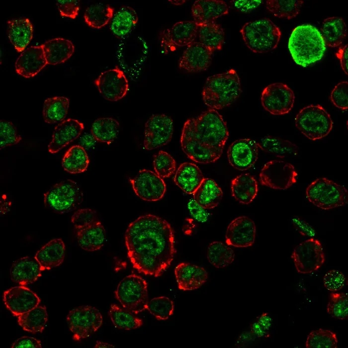 Immunocytochemistry - Anti-Neurofilament heavy polypeptide antibody [NF421] (AB187374)