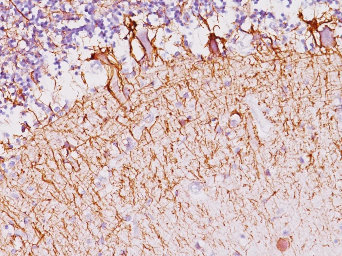 Immunohistochemistry (Formalin/PFA-fixed paraffin-embedded sections) - Anti-Neurofilament heavy polypeptide antibody [NF421] (AB187374)