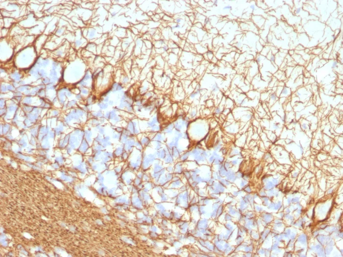 Immunohistochemistry (Formalin/PFA-fixed paraffin-embedded sections) - Anti-Neurofilament heavy polypeptide antibody [NF421] (AB187374)