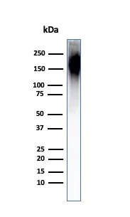 Western blot - Anti-Neurofilament heavy polypeptide antibody [NF421] (AB187374)