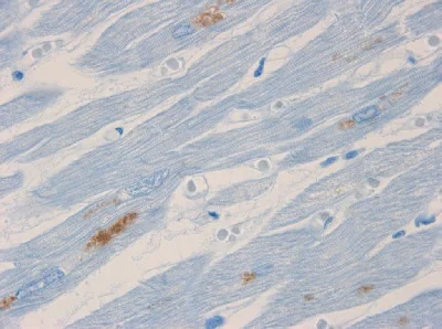 Immunohistochemistry (Formalin/PFA-fixed paraffin-embedded sections) - Anti-Neurofilament heavy polypeptide antibody [RNF404] (AB8972)
